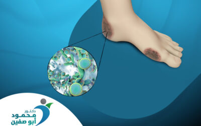 القدم السكري