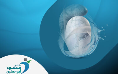 القيلة المائية