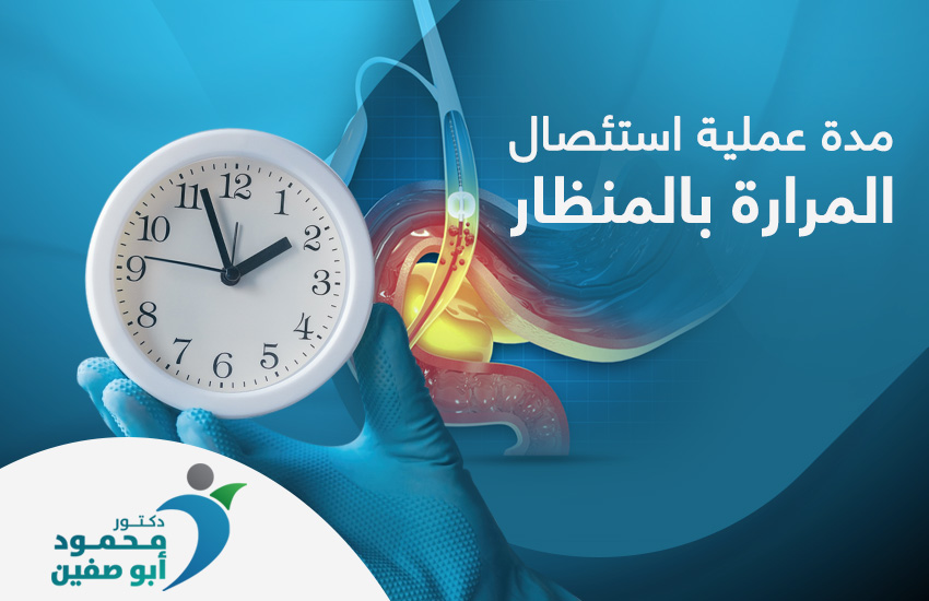 مدة عملية استئصال المرارة بالمنظار