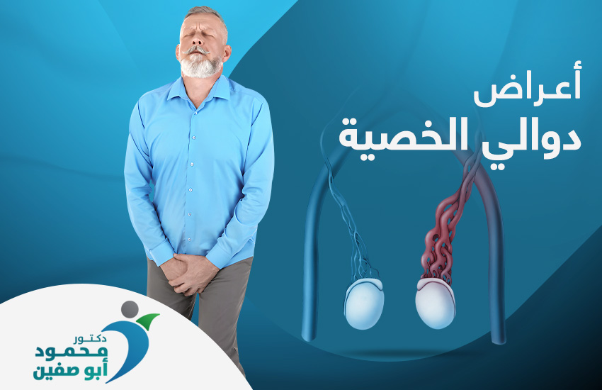 اعراض-دوالي-الخصية أعراض دوالي الخصية