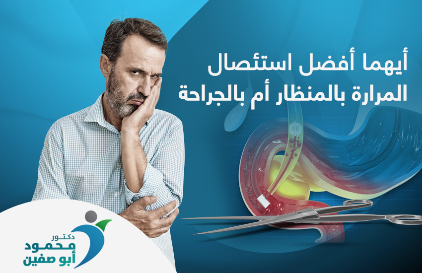 أيهما أفضل استئصال المرارة بالمنظار أم بالجراحة