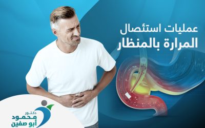 هل عملية استئصال المرارة بالمنظار خطيرة