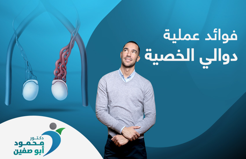 فوائد عملية دوالي الخصية