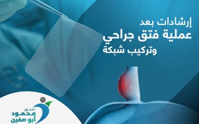 إرشادات بعد إجراء عملية فتق جراحي وتركيب شبكة