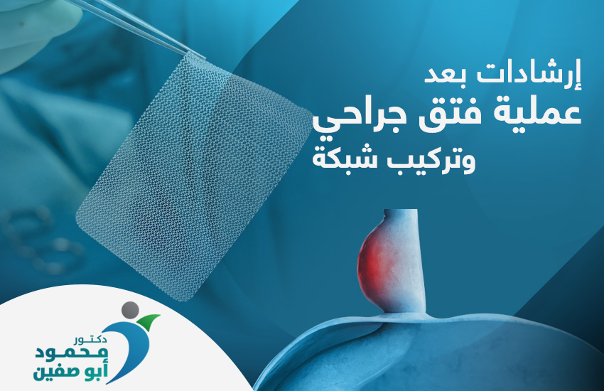 إرشادات بعد إجراء عملية فتق جراحي وتركيب شبكة
