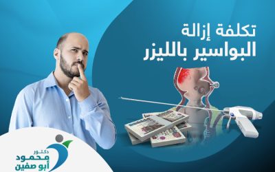 أهم العوامل المؤثرة في تحديد تكلفة إزالة البواسير بالليزر