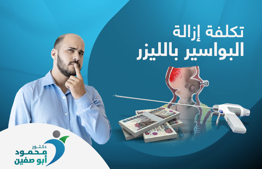 تكلفة إزالة البواسير بالليزر