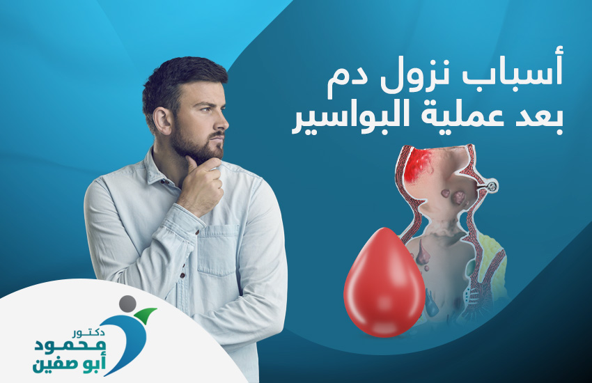 أسباب نزول دم بعد عملية البواسير أسباب نزول دم بعد عملية البواسير