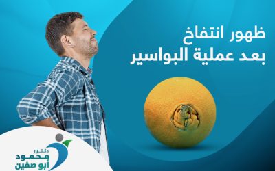 أسباب ظهور انتفاخ بعد عملية البواسير وأهم طرق الوقاية منها