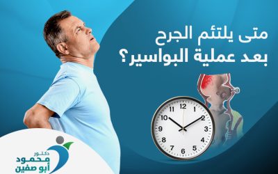 متى يلتئم الجرح بعد عملية البواسير بالليزر
