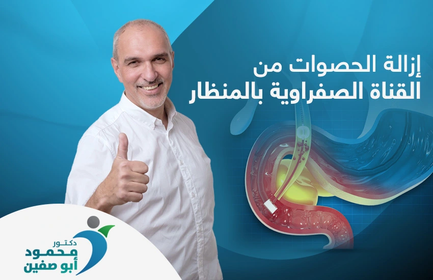 إزالة الحصوات من القناة الصفراوية بالمنظار بدون جراحة
