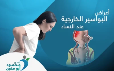 ما هي اعراض البواسير الخارجية عند النساء وعلاجها