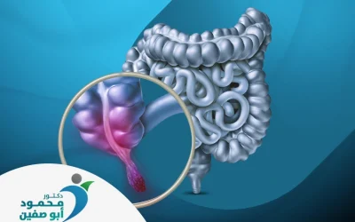 التهاب الزائدة الدودية للاطفال