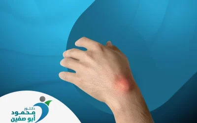 الكيس الزلالي