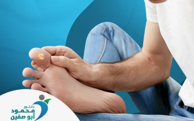 كيفية علاج عين السمكة