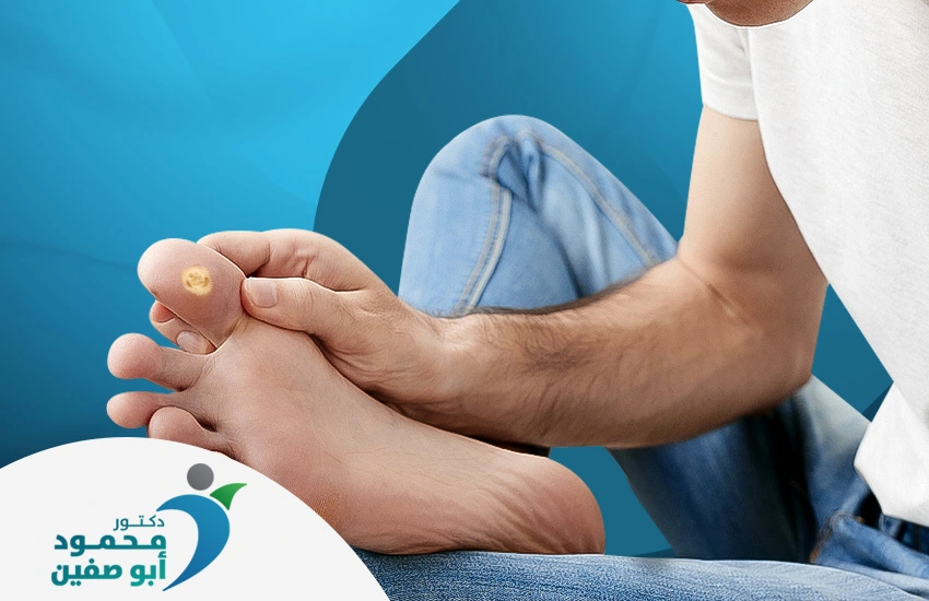 علاج عين السمكة