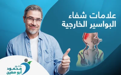 ما علامات شفاء البواسير الخارجية؟