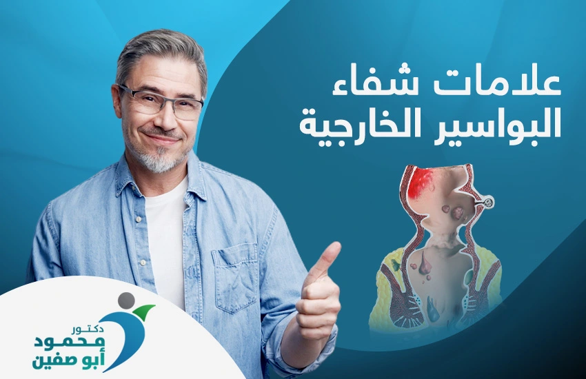 علامات شفاء البواسير الخارجية