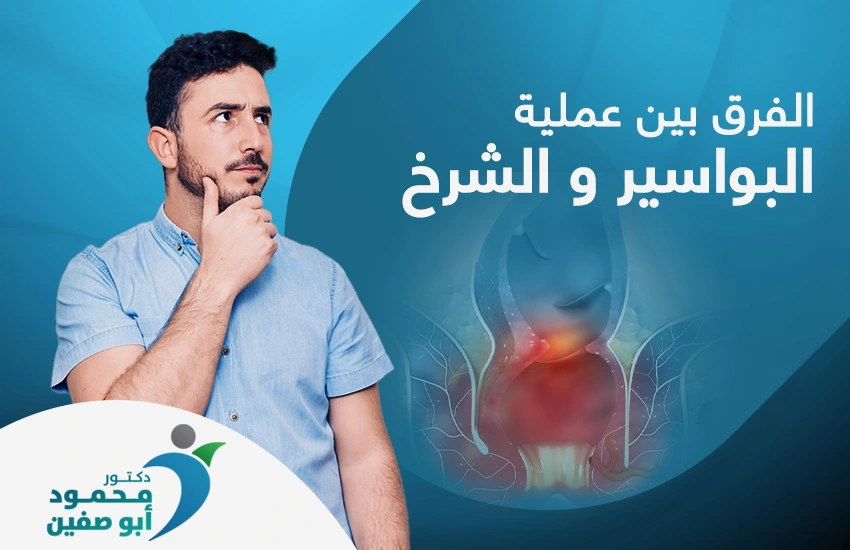 عملية البواسير والشرخ
