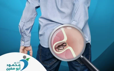 علاج الناسور العصعصي بالليزر| تقنية حديثة لشفاء أسرع