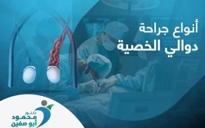 ما انواع جراحة دوالي الخصية؟ وكم تبلغ نسبة نجاحها؟