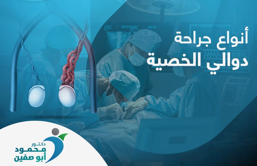 انواع جراحة دوالي الخصية