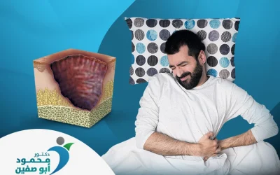 علاج قرح الفراش و اسبابها