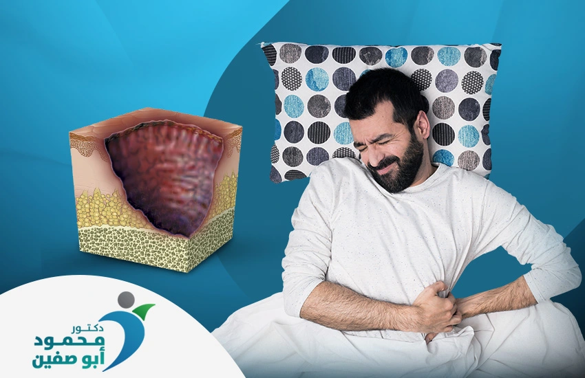علاج قرح الفراش