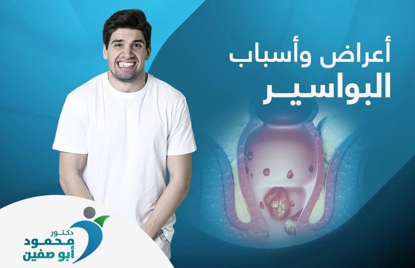 أعراض وأسباب البواسير
