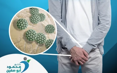 علاج السنط التناسلي