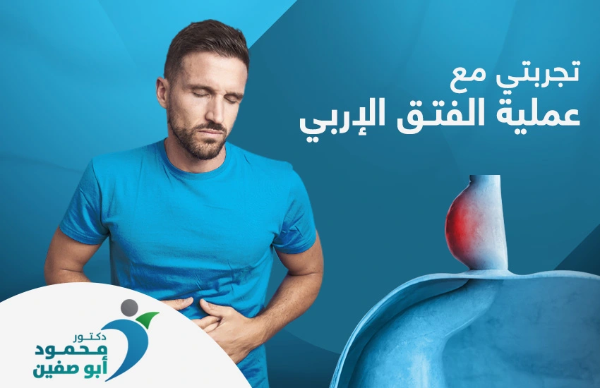 تجربتي مع عملية الفتق الإربي