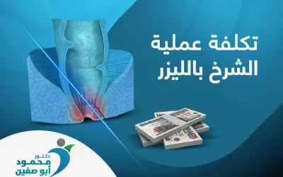 العوامل المؤثرة في تكلفة عملية الشرخ بالليزر