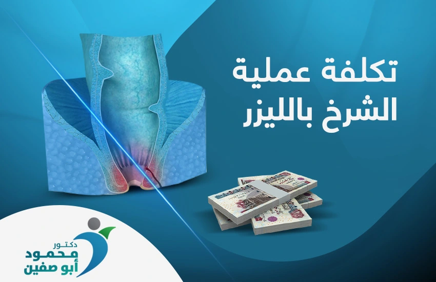 العوامل المؤثرة في تكلفة عملية الشرخ بالليزر