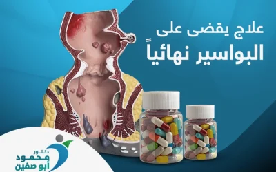أفضل علاج يقضي على البواسير نهائيا 
