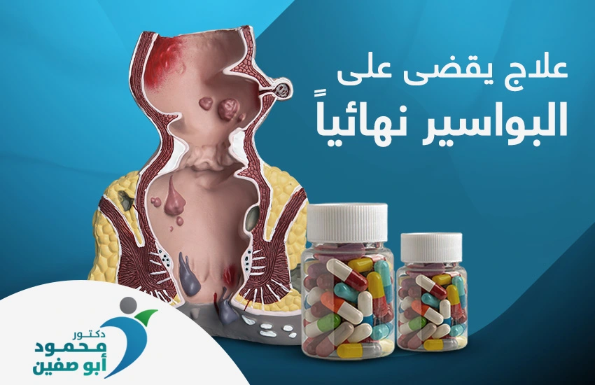 أفضل علاج يقضي على البواسير نهائيا 
