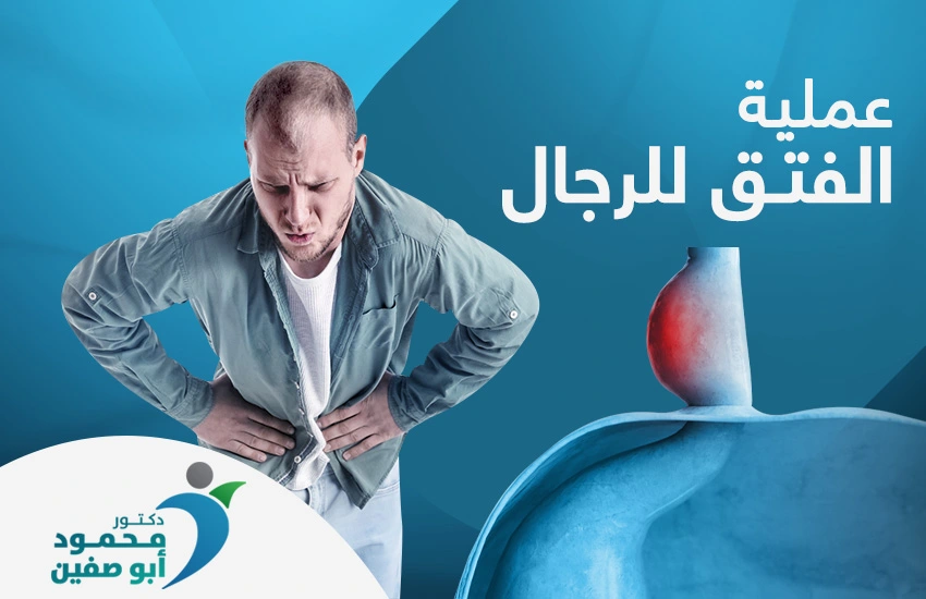 عملية الفتق للرجال