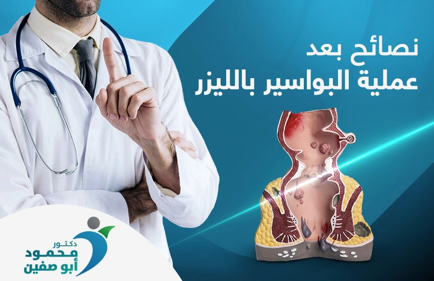 نصائح بعد عملية البواسير بالليزر