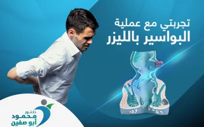 تعرف على تجربتي مع عملية البواسير بالليزر