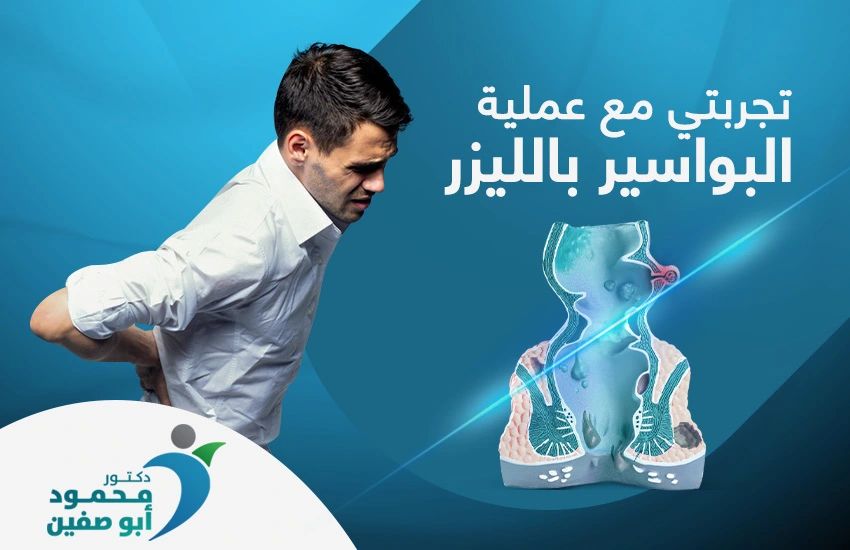 تجربتي مع عملية البواسير بالليزر