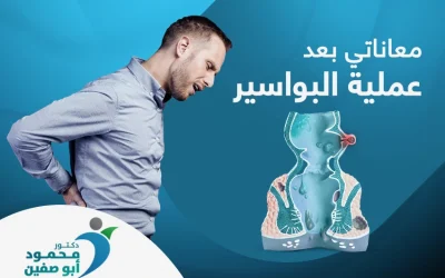 إلى متى تستمر معاناتي بعد عملية البواسير؟
