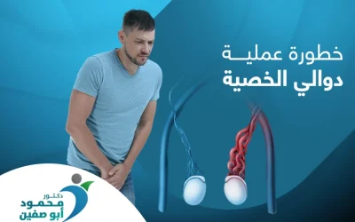 خطورة عملية دوالي الخصية: كيف تتغلب على الألم بعدها؟