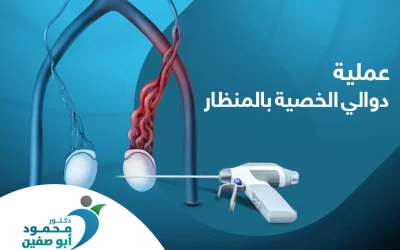 عملية دوالي الخصية بالمنظار الحل الأمثل لعلاج دوالي الخصية