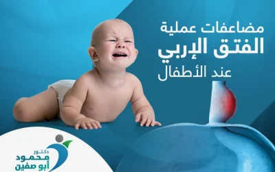 تعرف إلى مضاعفات عملية الفتق الاربي عند الاطفال