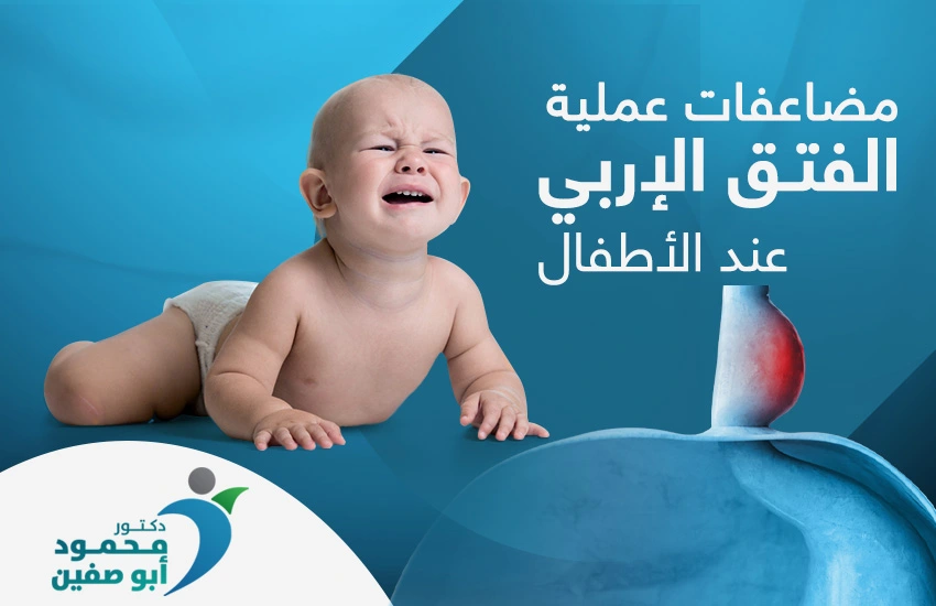 مضاعفات عملية الفتق الاربي عند الاطفال