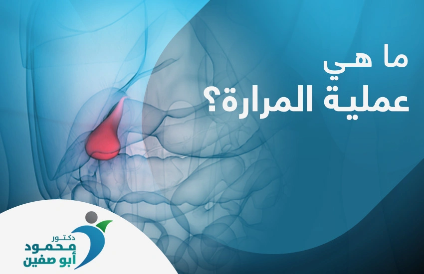 ما هي عملية المرارة