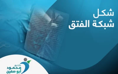 هل يؤثر شكل شبكة الفتق في نتيجة العملية؟