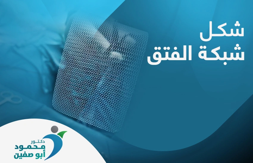 شكل شبكة الفتق