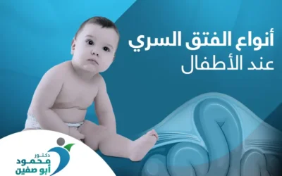 أسباب وأنواع الفتق السري عند الأطفال بالصور