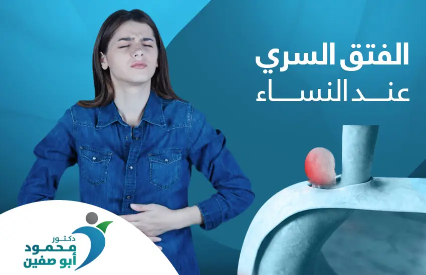 الفتق السري عند النساء