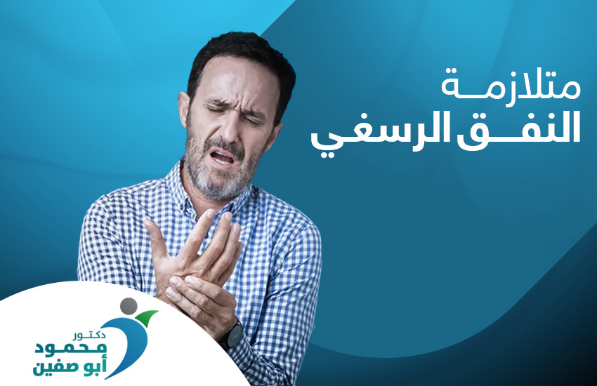 متلازمة النفق الرسغي